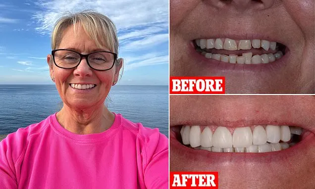 Mandy's teeth grew more crooked with age... until a £4,000 makeover