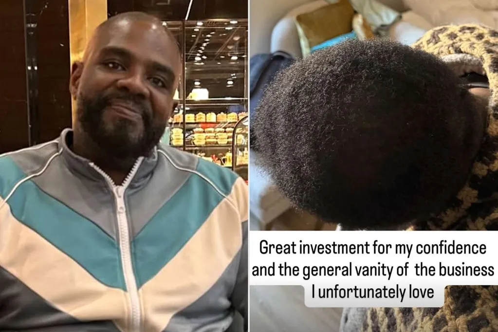 Comedian Ron Funches Reveals He Was in the 'Shedding Phase' of Hair Transplant While Filming 'Traitors'
