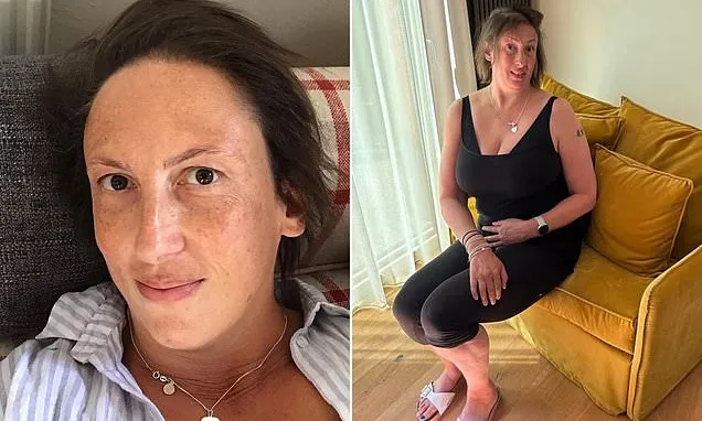 Miranda Hart reveals she has hurt her ankle and has extreme fear