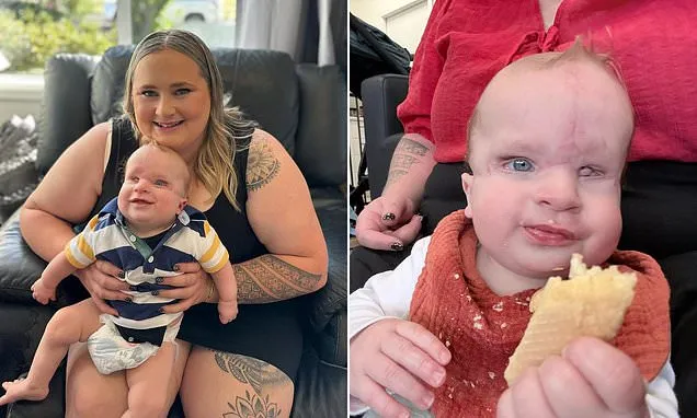 My baby was scarred by a rare condition in the womb