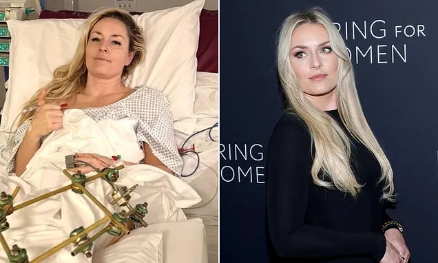 Surgeon reveals how dangerously close Lindsey Vonn came to losing leg
