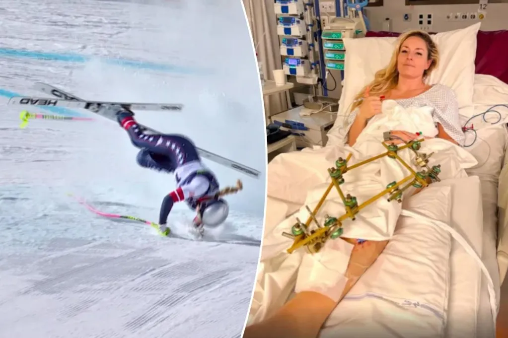 Lindsey Vonn set for 'further surgeries' after flying back to US