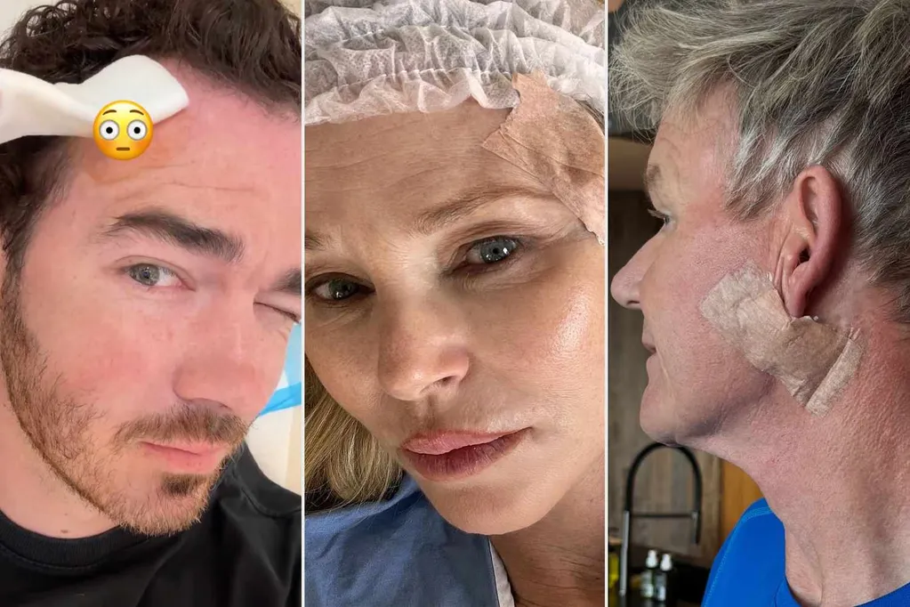 Celebs Who Have Had Skin Cancer -- and What They Do Now to Prevent Recurrence