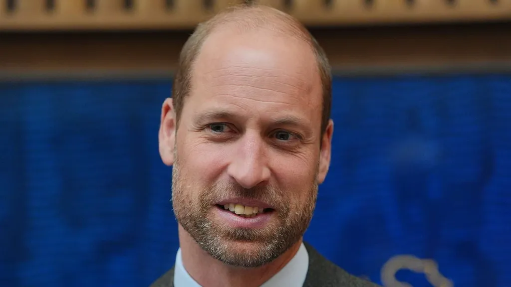 Expert reveals how hair loss runs in the British Royal Family