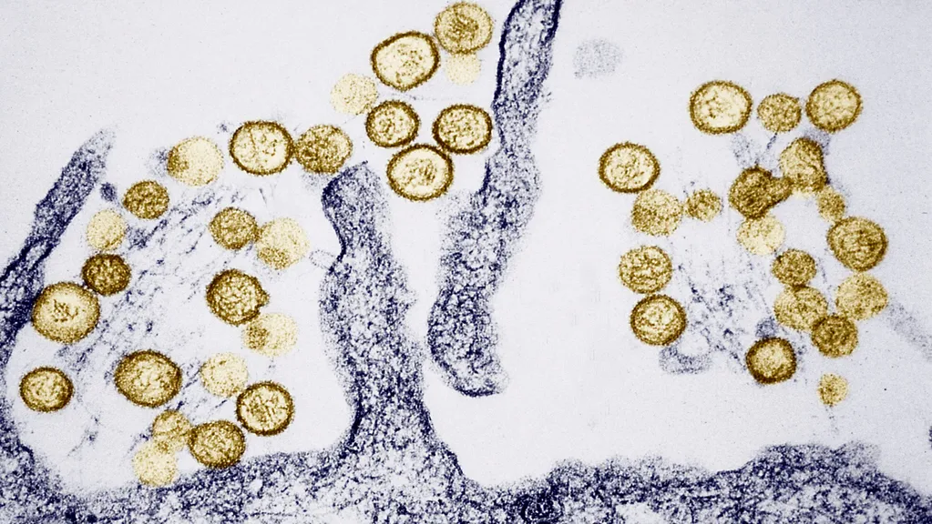What Is Hantavirus, Which Is Linked to the Deaths of 3 People Aboard a Cruise Ship?
