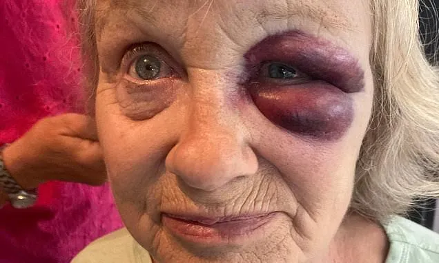 Pensioner, 68, 'lucky' to be alive after accident before dad's funeral