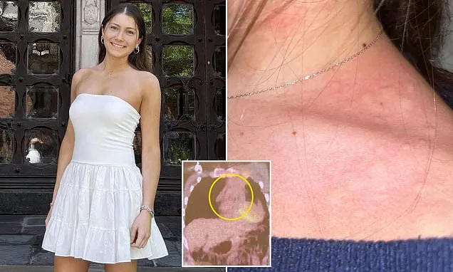 I ignored my itchy legs and cold symptoms. Then doctors found a tumor