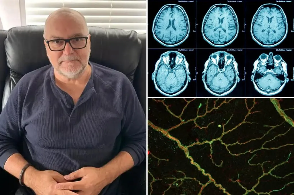 Australian man's HR meeting leads to staggering health diagnosis