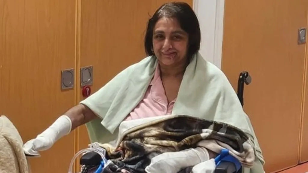 Woman loses all her limbs 'after being licked by a dog'