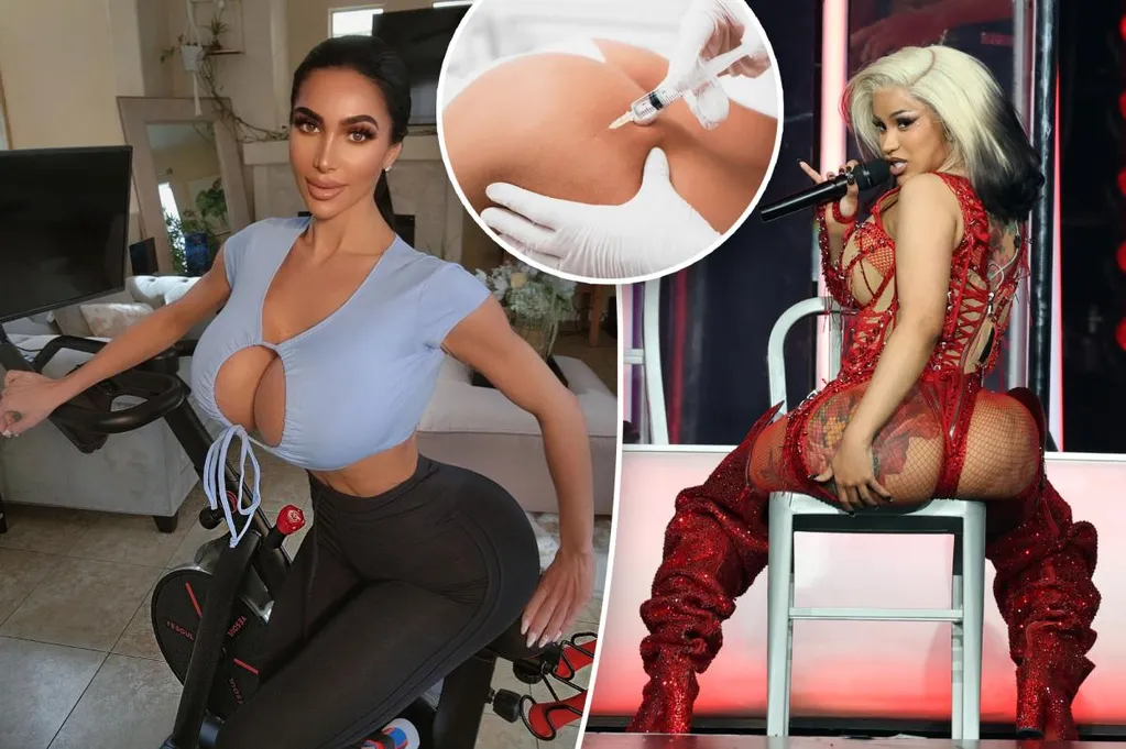 Model dies from illegal 'liquid BBL'  --  what to know about the risky procedure that left Cardi B in the 'craziest pain ever'