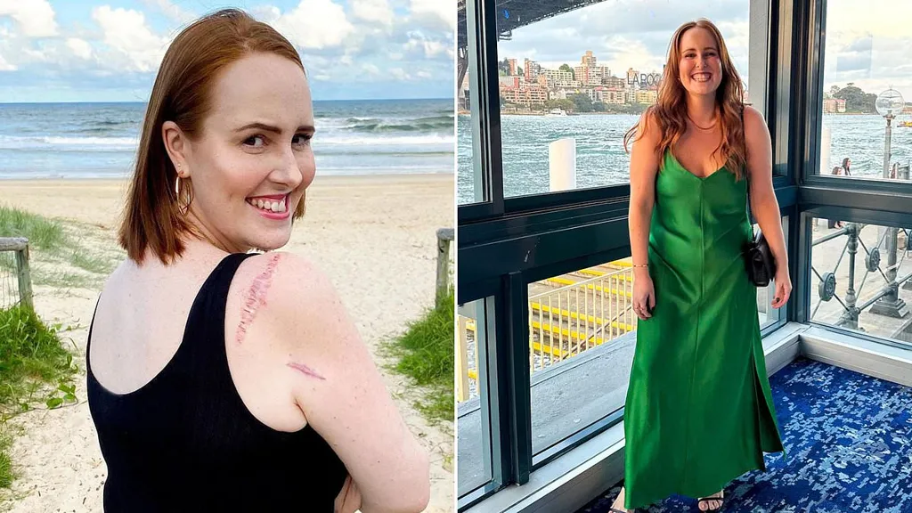 I was 29 when a doctors dismissed the deadly symptom of my melanoma