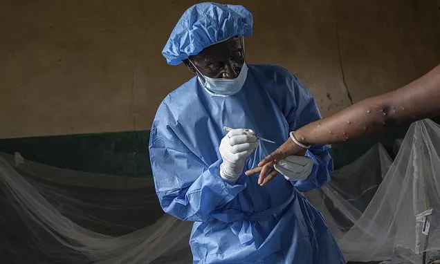 Why is Congo struggling to contain mpox?